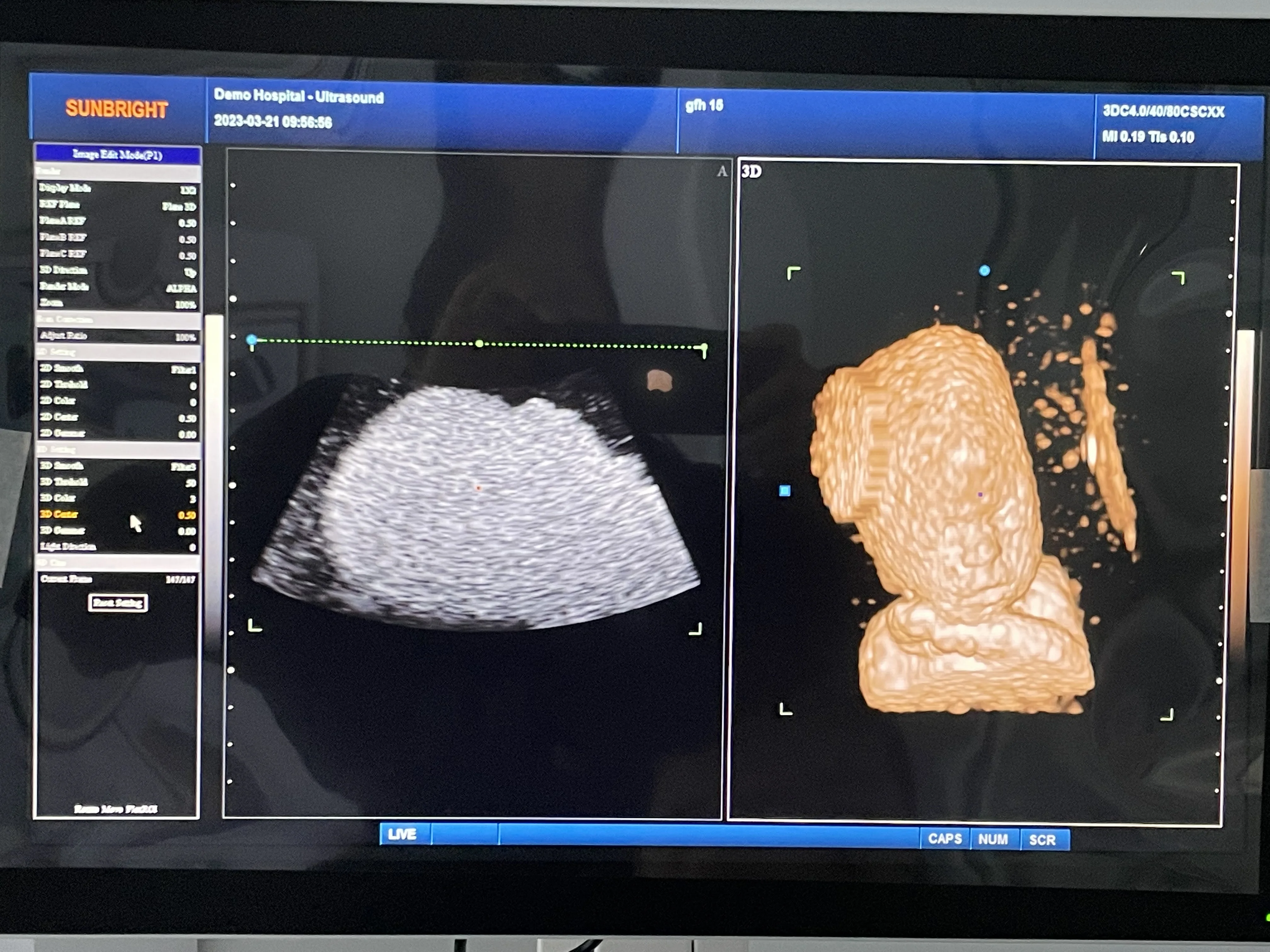 Newest trolley mobile colour doppler ultrasound machine 3D 4D Mobile cardiac echocardiogram