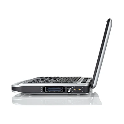  Chison SonoBook9 Смарт 4D ноутбук использования человеком цветной УЗИ-15-дюймовый ЖК-монитор сердечно-сосудистых заболеваний радиологическое