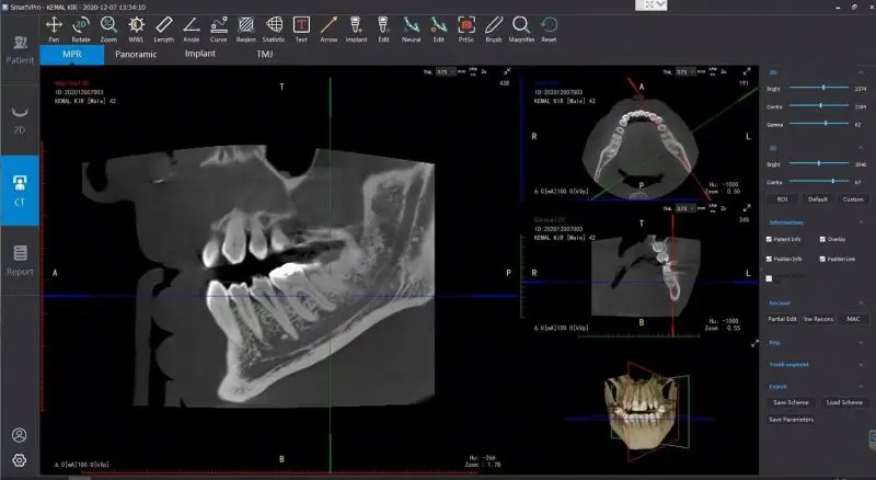 Горячая продажа стоматологическая рентгеновская машина Youjoy X Ray клиника