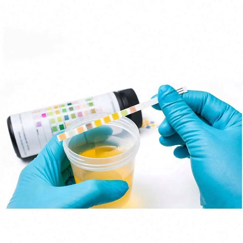Home One-stop Detection Of Ascorbic Acid, Specific Gravity, Protein Medical Test Strip Kit