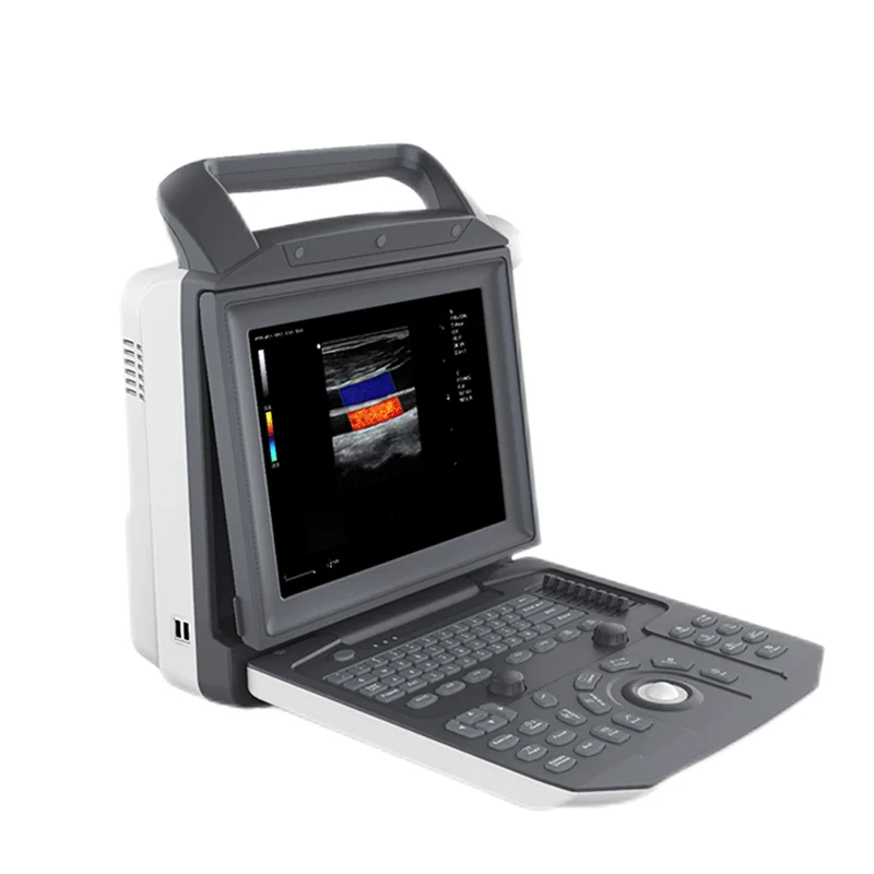 Medico Ecografo Portatil Ultrasonido Portable Color Doppler CW TDI Cardiac Ultrasound Machine Price