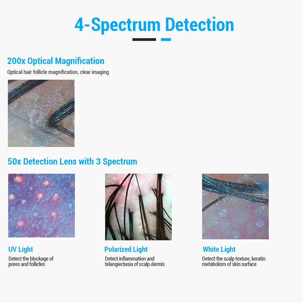 Wholesale price 15 Inch Digital HD Screen Home Use Skin And Scalp Hair Analyzer