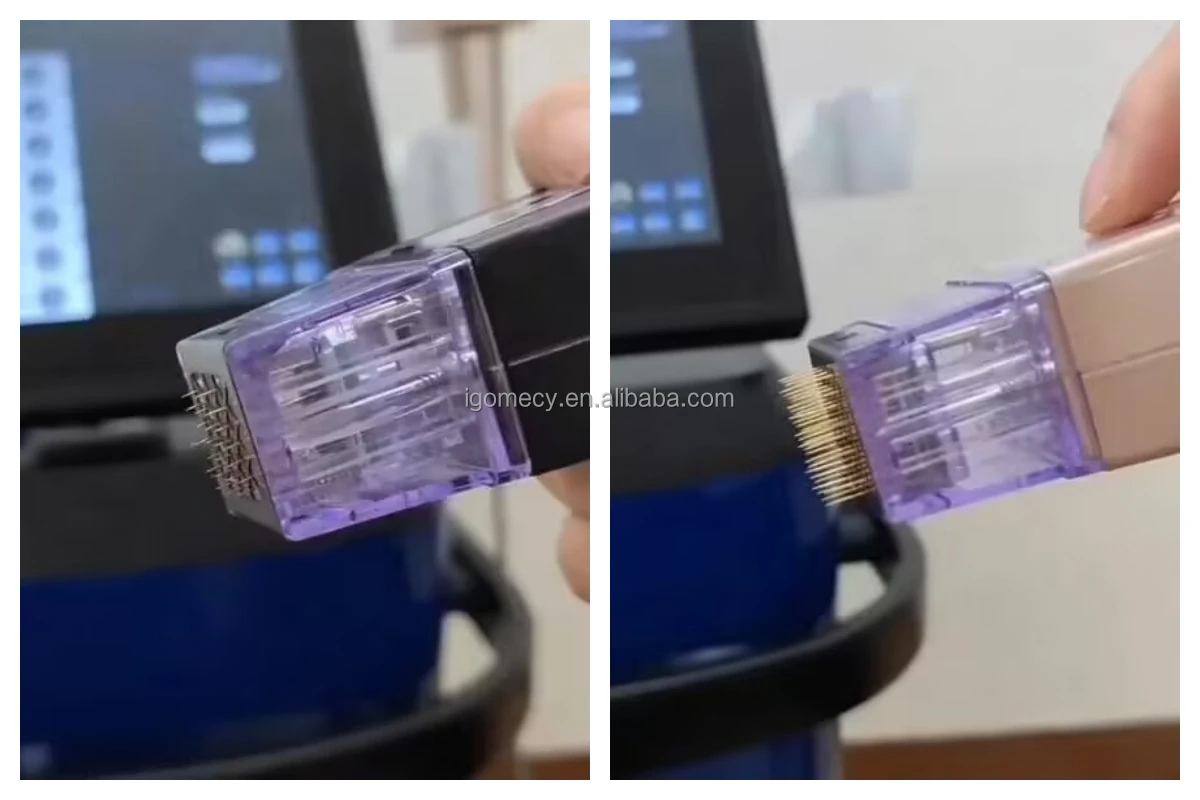 Morpheus-8-Wrinkle-Remover-Fractional-Radio Frequency-Vivace-Rf-Needle-Skin Tightening-Disposable Microneedling-Machine-Hot-Sale