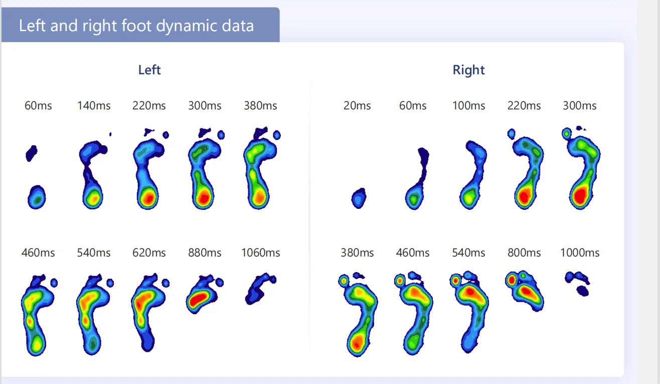 foot dynamic analysis.png
