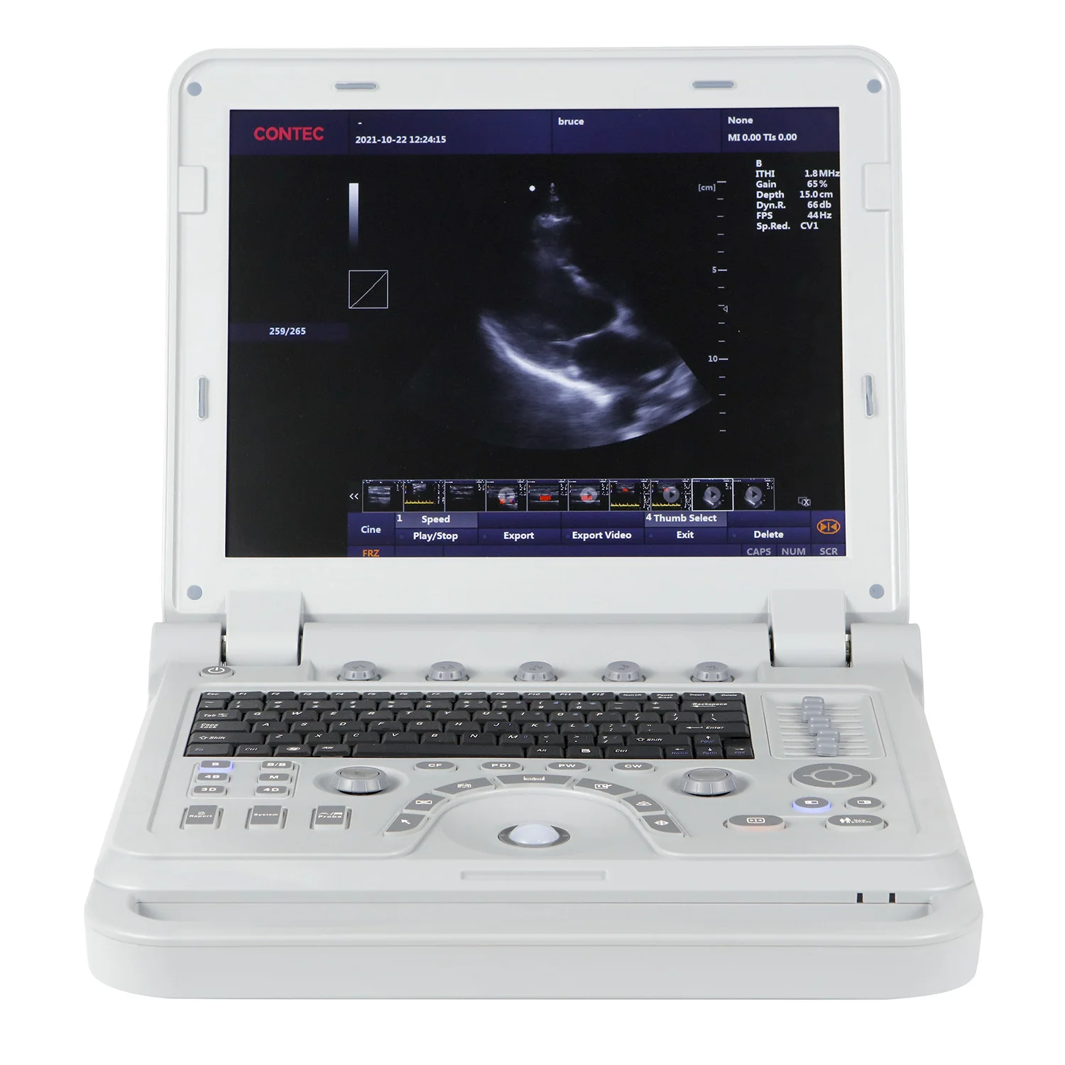 CMS1700A Low Price Laptop USG Scanner 2D Portable Ultrasound Machine Human Pregnancy USG  Probe
