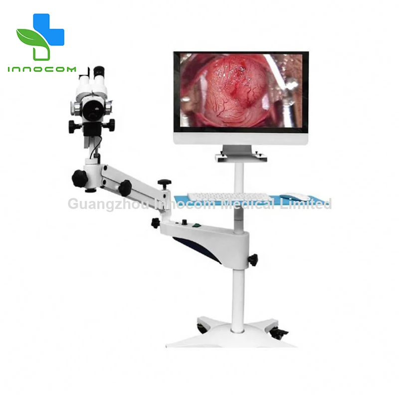 Well-sold china medical equipment video colposcope digital colposcope for gynecology infrared colposcope low cost