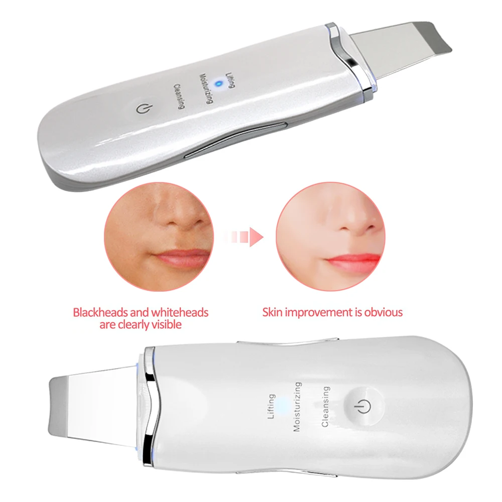 Facial Deep Cleansing Pore Acne Remover Dead Skin Scrubber Ultrasonic