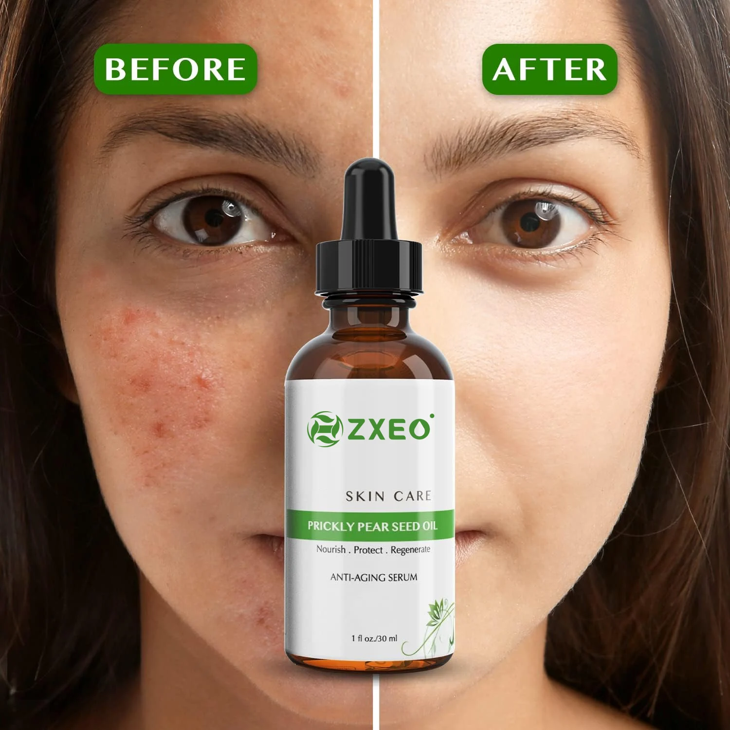 Customized Private Label 100% Pure Organic Prickly Pear Seed Oil Cactus Seed Oil