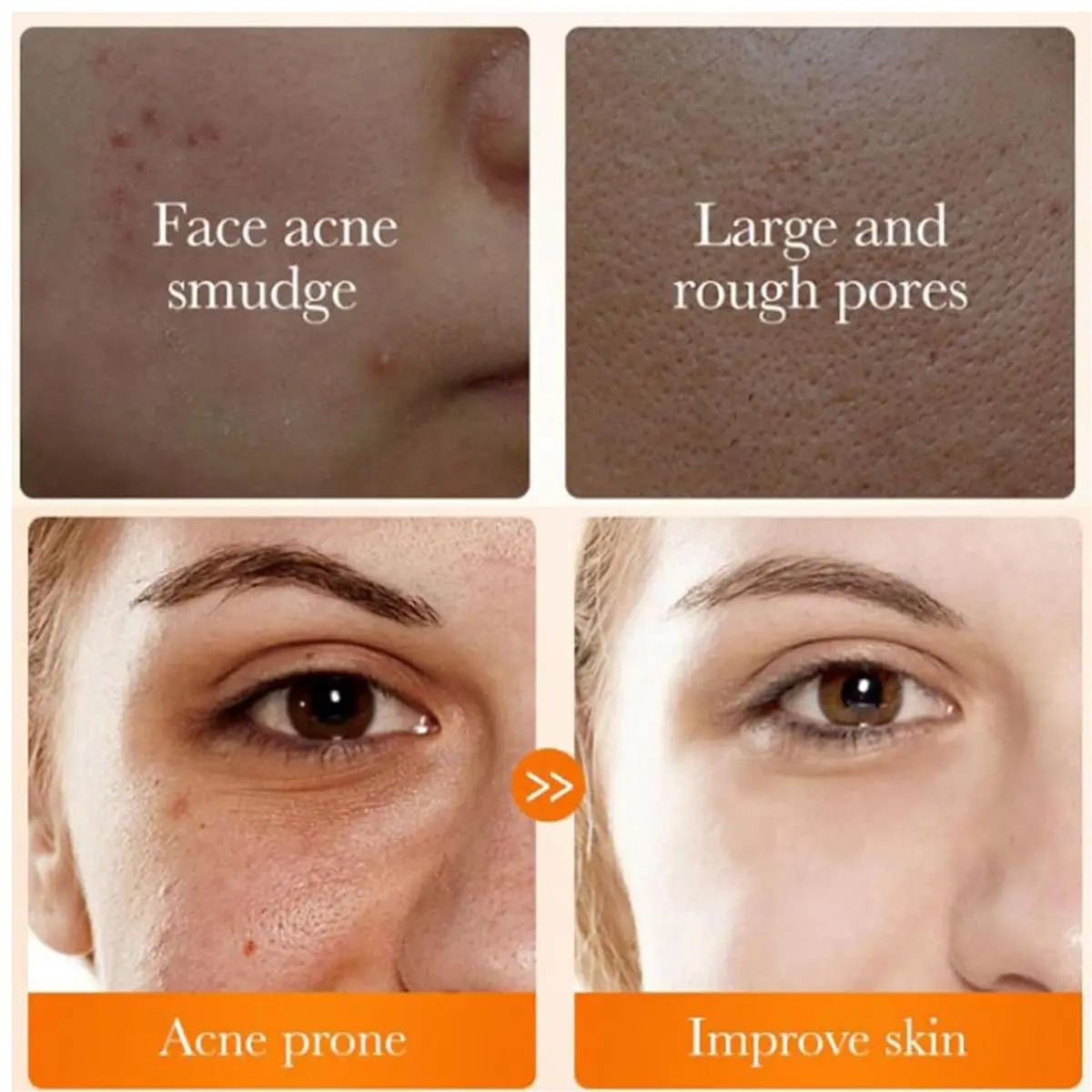 Natural Anti Acne Oil Control SkinCare Deep Cleansing Turmeric Cleansing Repair Face Wash Anti Acne Facial Cleanser