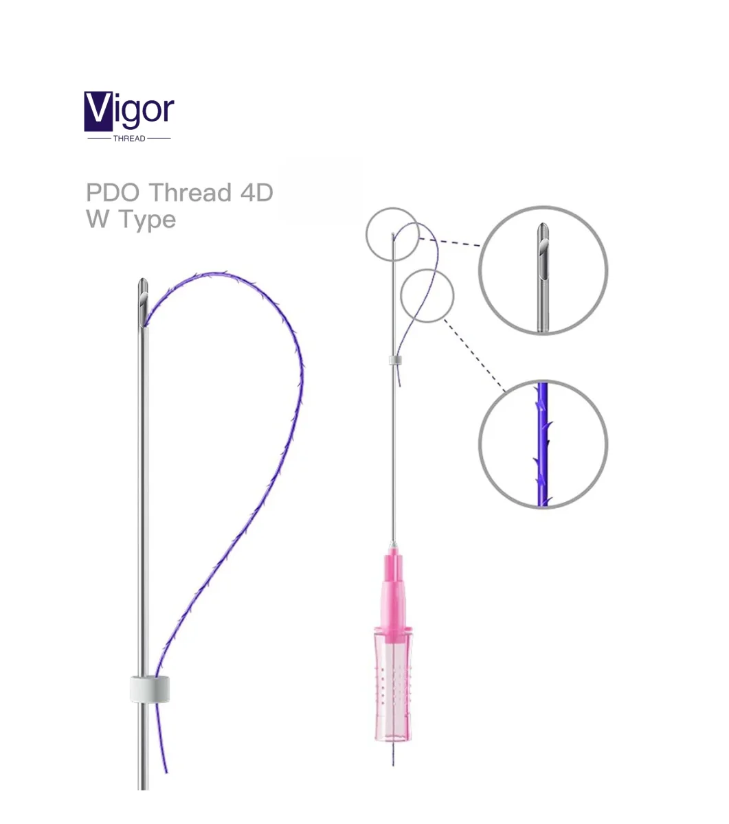 Vigor korean pdo barbed suture for the pdo thread lift double needle facial tension tornado pdo thread lift double needle