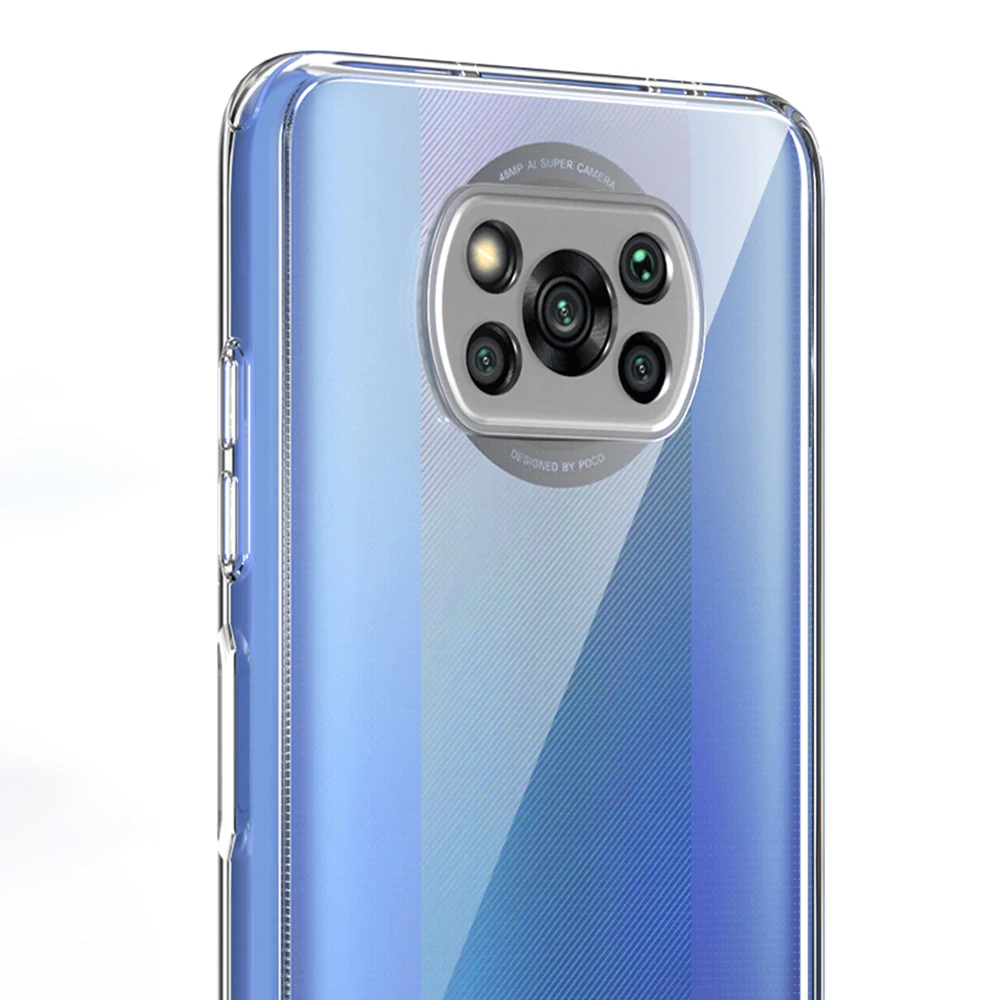  unique luxurious acrylic shockproof protective cell phone case for POCO X3 mobile back