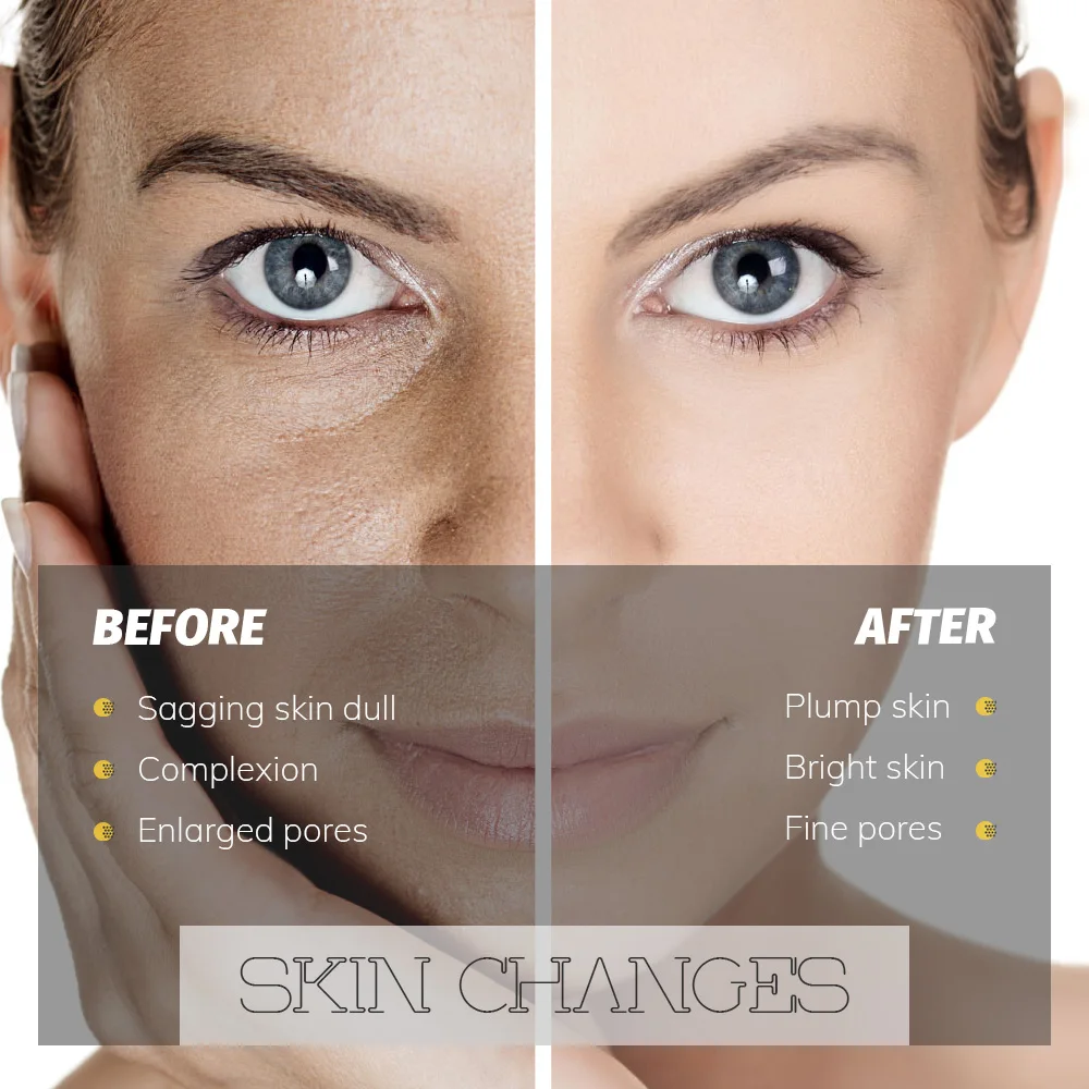 Private Label new arrival pure ginger essential oil ginger essential oil srttan ginger essential oil 100% natural