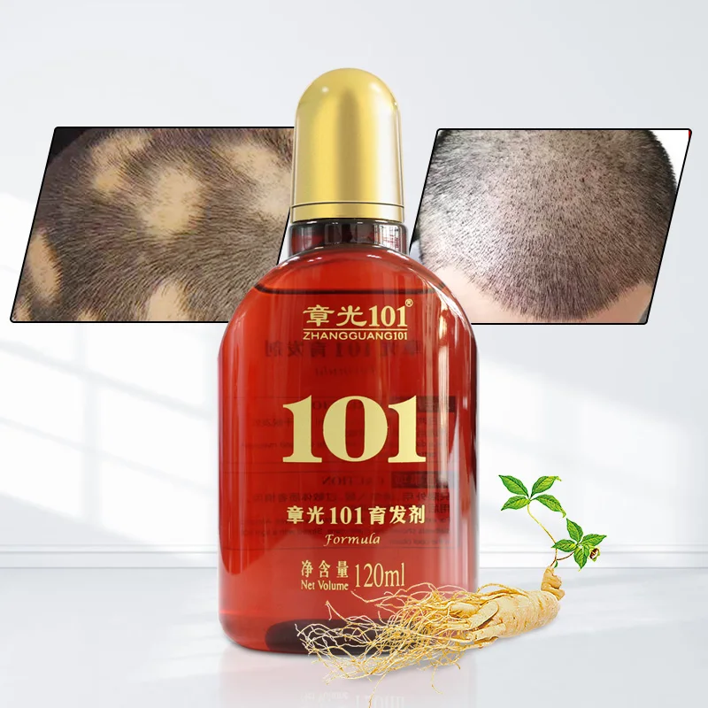 Highly Effective Ginseng and Ginger Extracts Hair Growth Oil for Alopecia