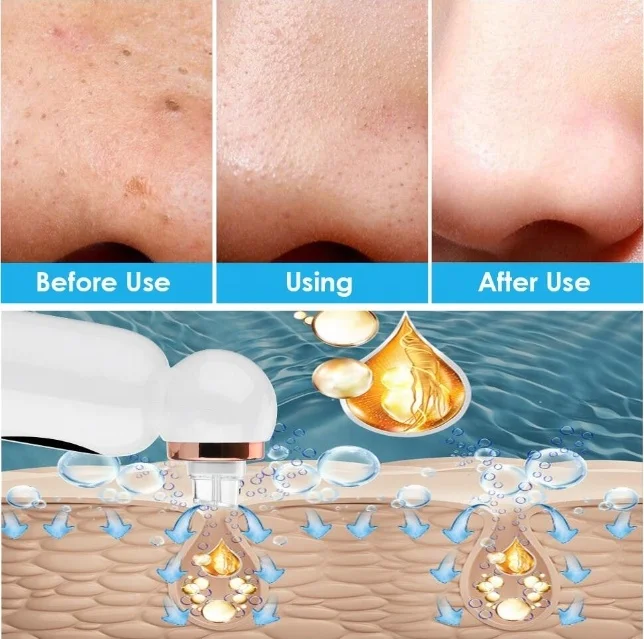 Pore Cleaner Blackhead Remover Vacuum Electric Vacuum Suction Pore Shrink Micro Small Bubble Facial Cleansing Machine Hand Held