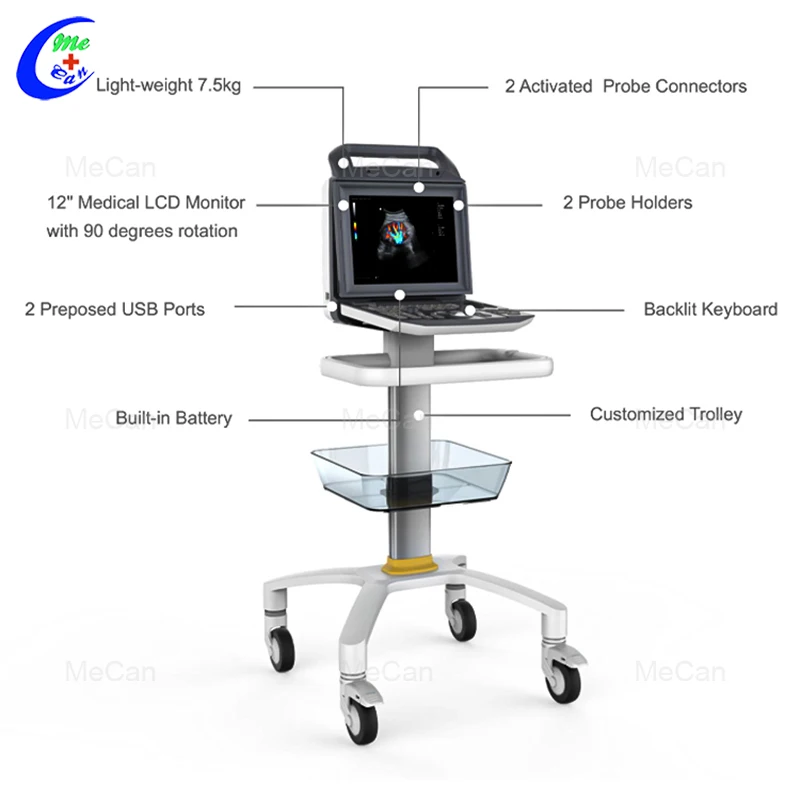 High Quality Portable Best Ultrasound Scanner Machine System 4D Ultrasound Machine With Probes For Clinic