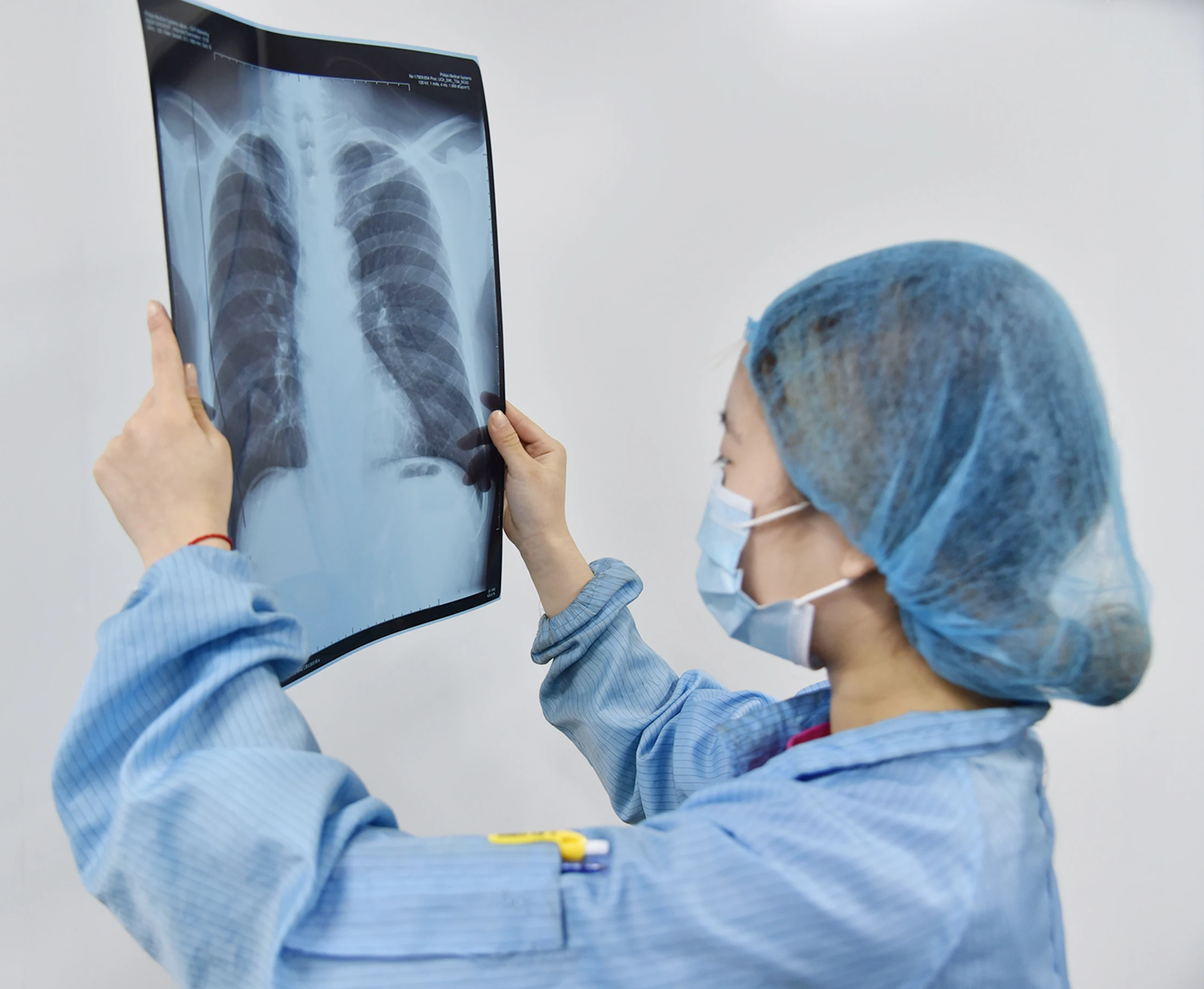 hot sale 8*10, 14*17 inch X Ray Image Film thermal x ray dry film for Agfa 5302