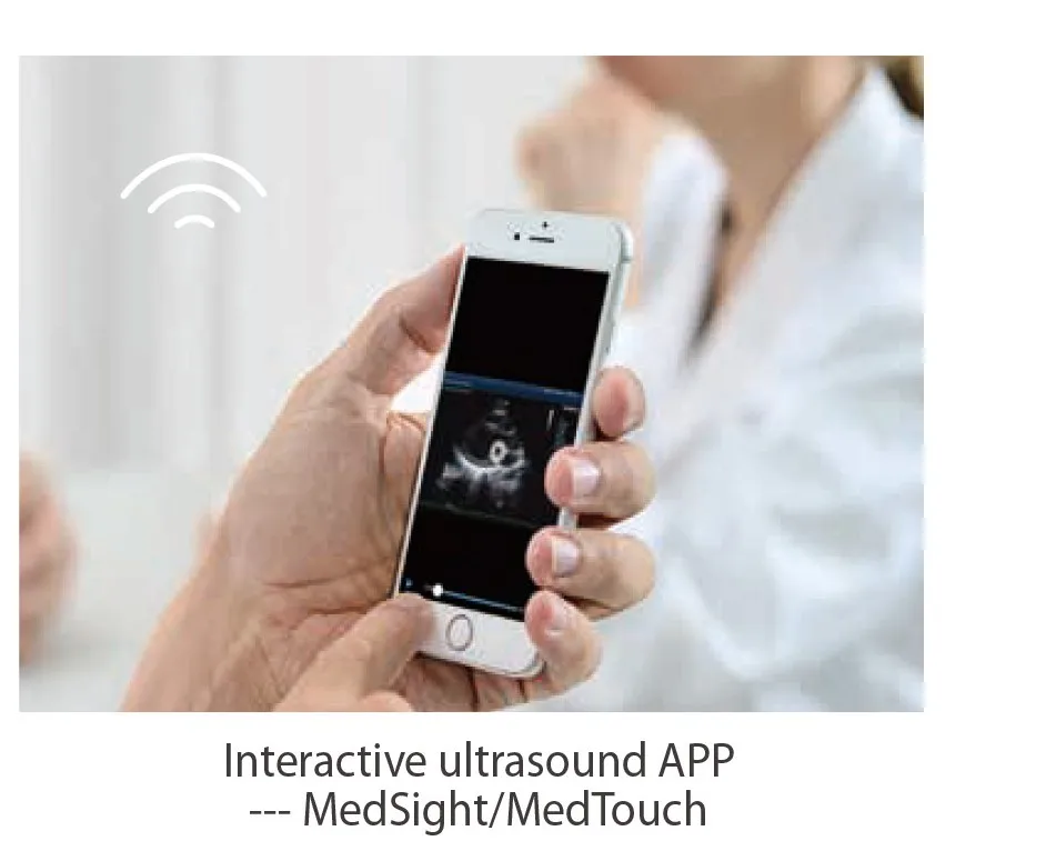 High quality Mindray DC-60 Diagnostic Ultrasound System for hospital use