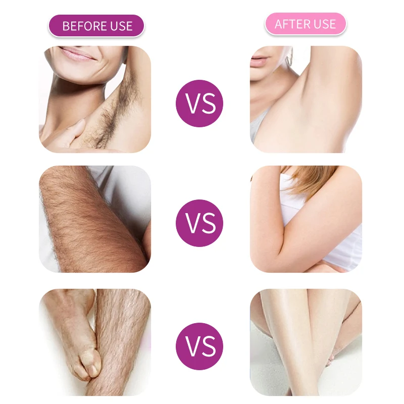 VANGIN 150ml Organic Ingredients Permanent Hair Inhibitor Body Depilatory Cream Hair Removal Spray For Men And Women