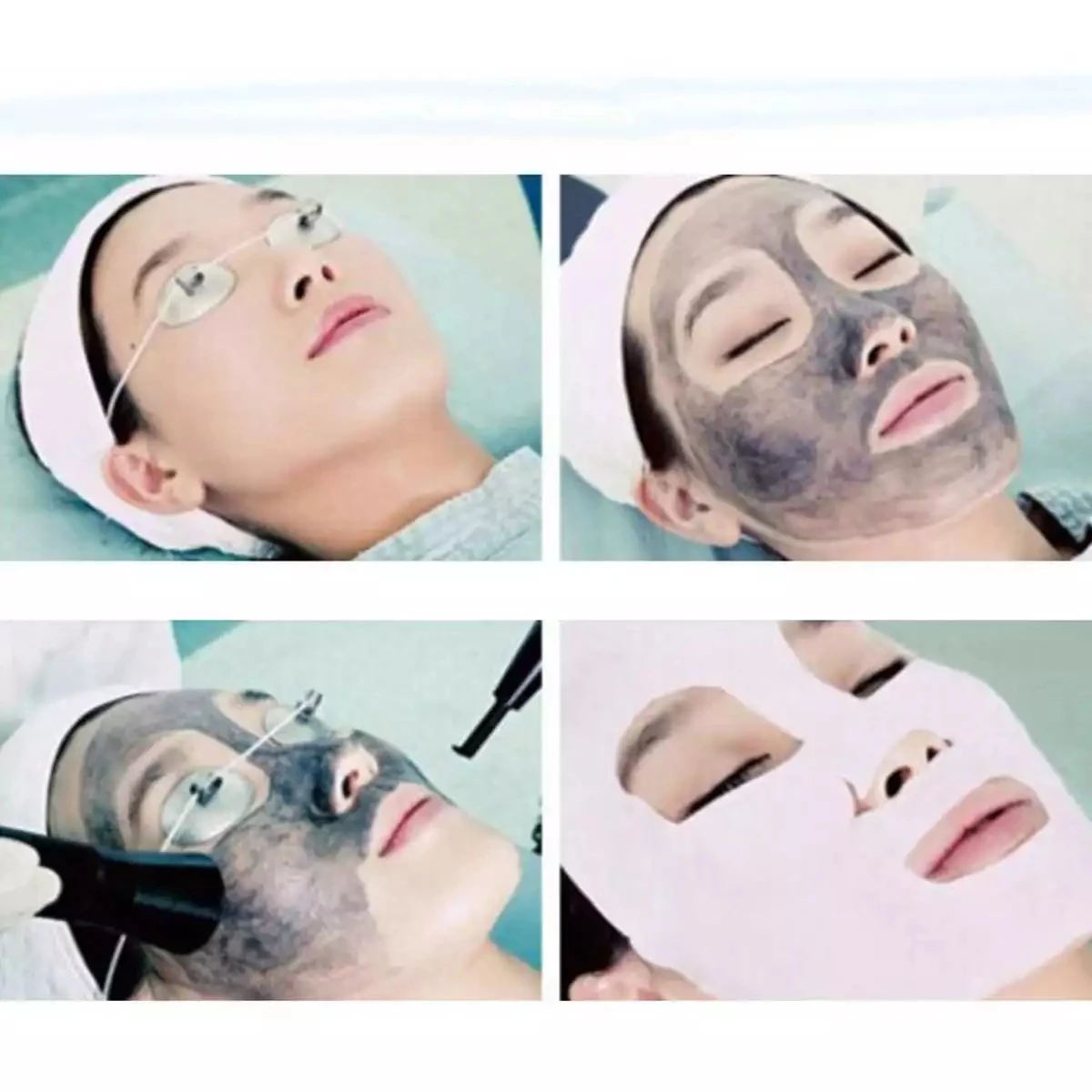 HOT Professional Laser Soft Carbon Laser Cream Peel Carbon Gel  80mm For Laser Machine Skin Cleansing Carbon