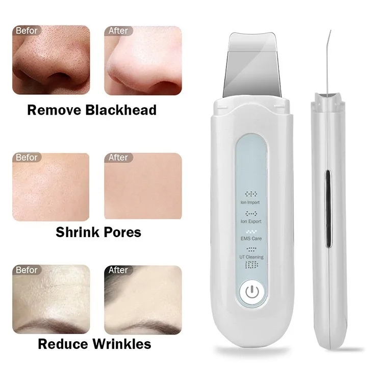 2023 ultrasonic skin scrubber professional sonic cleaning Ion ultrasound facial spatula face peeling home use