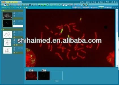  SH Chromosome Авто кариотипирование образ