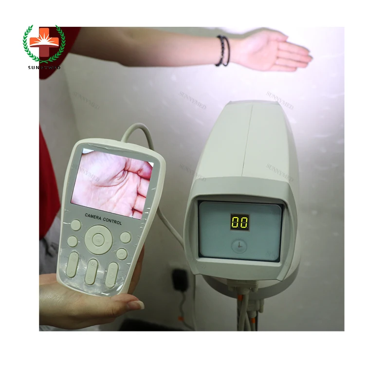 Sunnymed SY-F005 портативный цифровой видео влагалища кольпоскоп