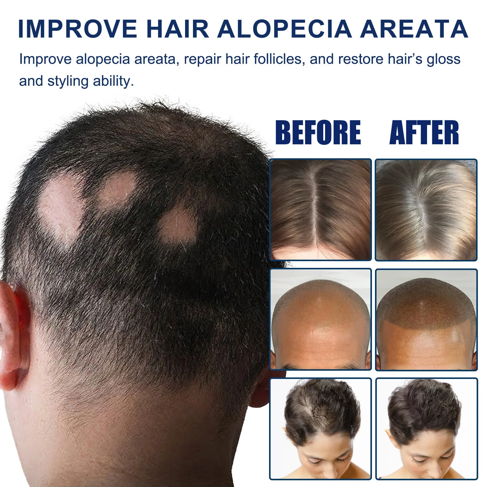 OEM Scalp dense hair care cream Cares for follicles to strengthen hair moisturize thick hairline and strengthen hair