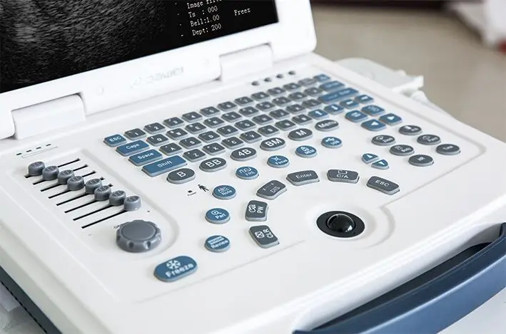 DW-580 price laptop ultrasound, cheap ultrasound equipment