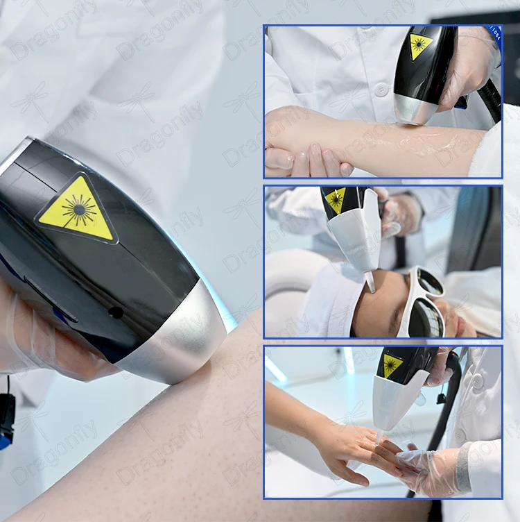 Permanent hair removal laser ice 4k screen 808nm diode laser hair removal Life time maintenance machine