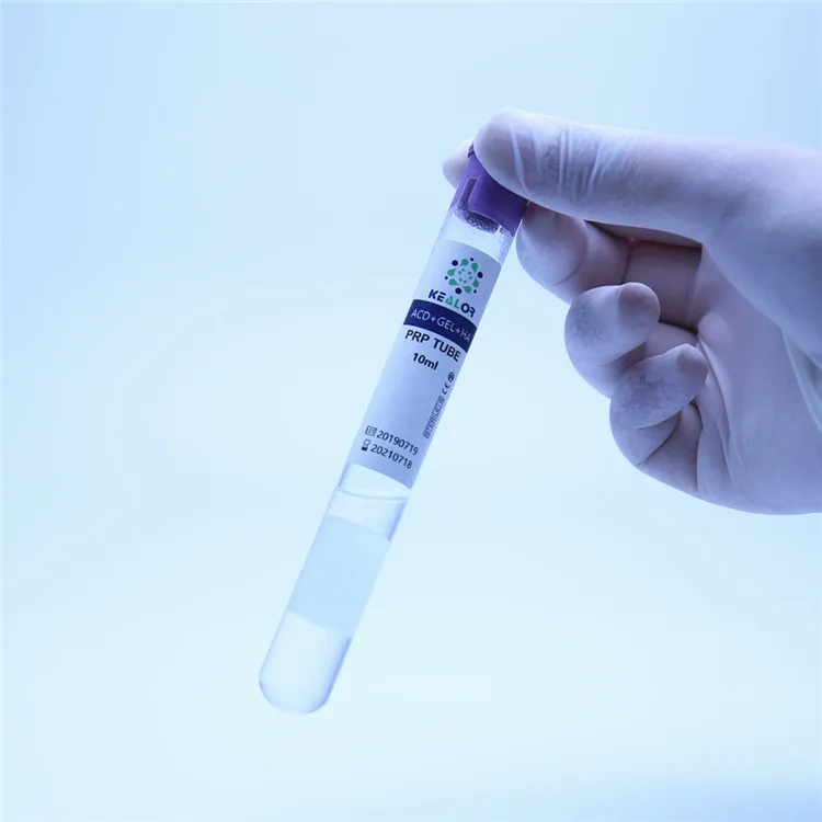 Sodium citrate  platelet rich plasma prp tube