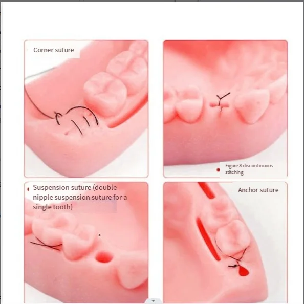 Dental Module Suture Training Kit Simulated Oral Suture Model for Dental Medical Training Tooth and Gingival Suture Practice Pad