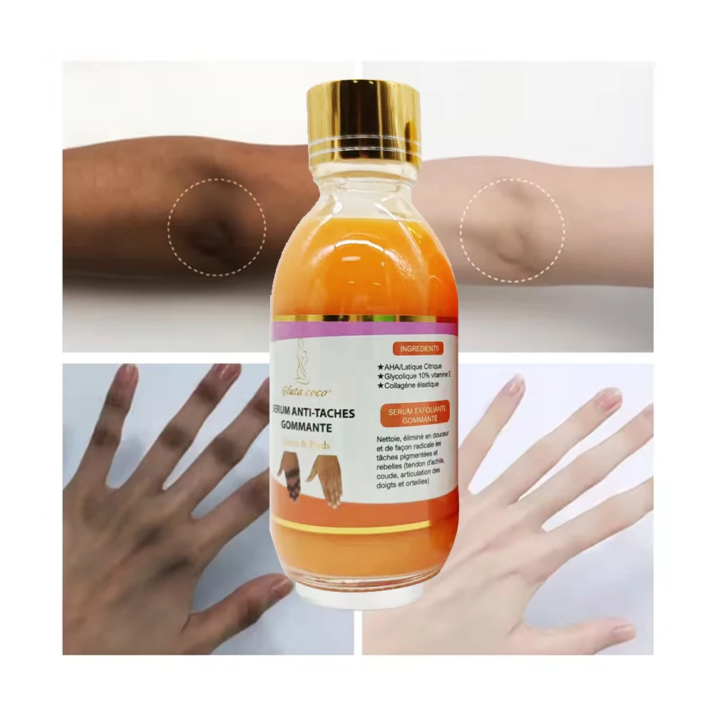 Dark Knuckle Remover Whitening Serum Hand Knuckle Glow Oil Dark Spot Body Facial Serum Skin Whitening Serum For Black Skin