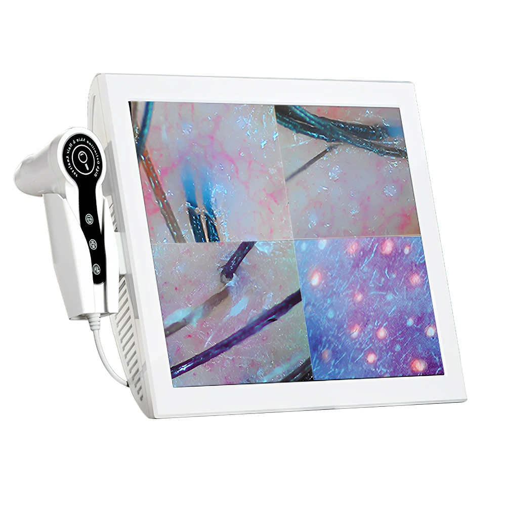 Home use 5 in 1 scalp hair analyzer beauty skin hair scalp detector analyzer professional beauty machine