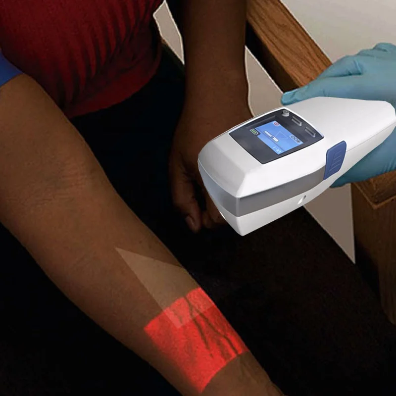 
High Quality Portable Hospital Clinic Infrared Accu Vein Finder Vein Detector 