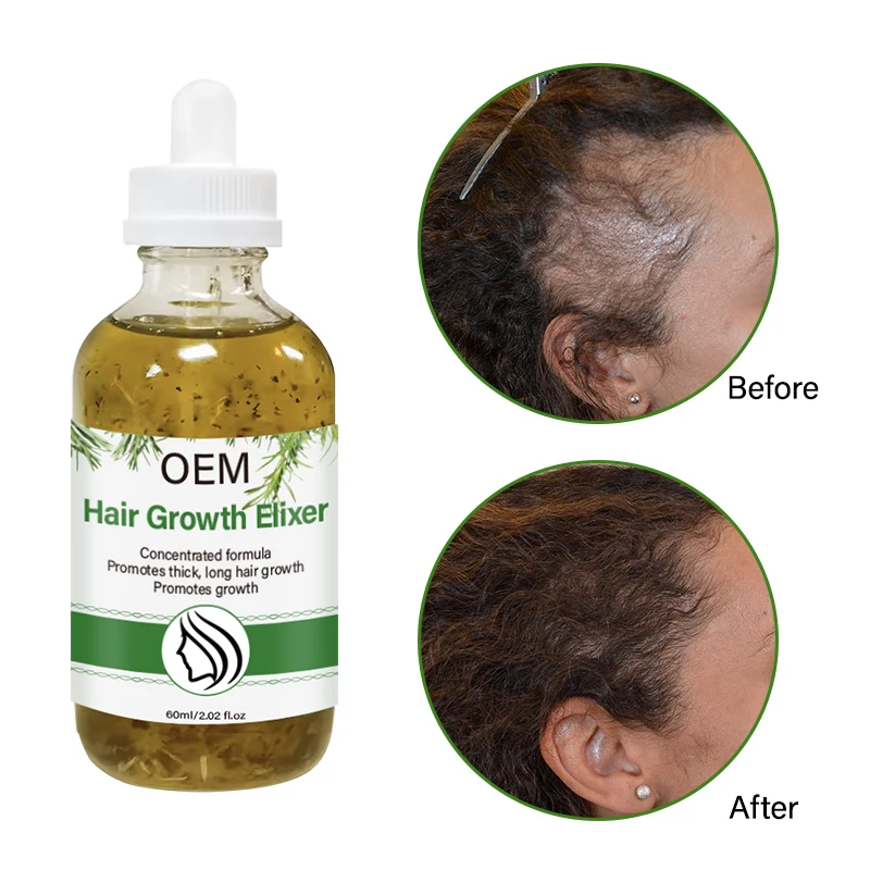 Customised Herbal Blend Rosemary Infusion Extreme Hair Growth Scalp Massage Oil Mint Castor Anti Alopecia Hair Strengthening Oil