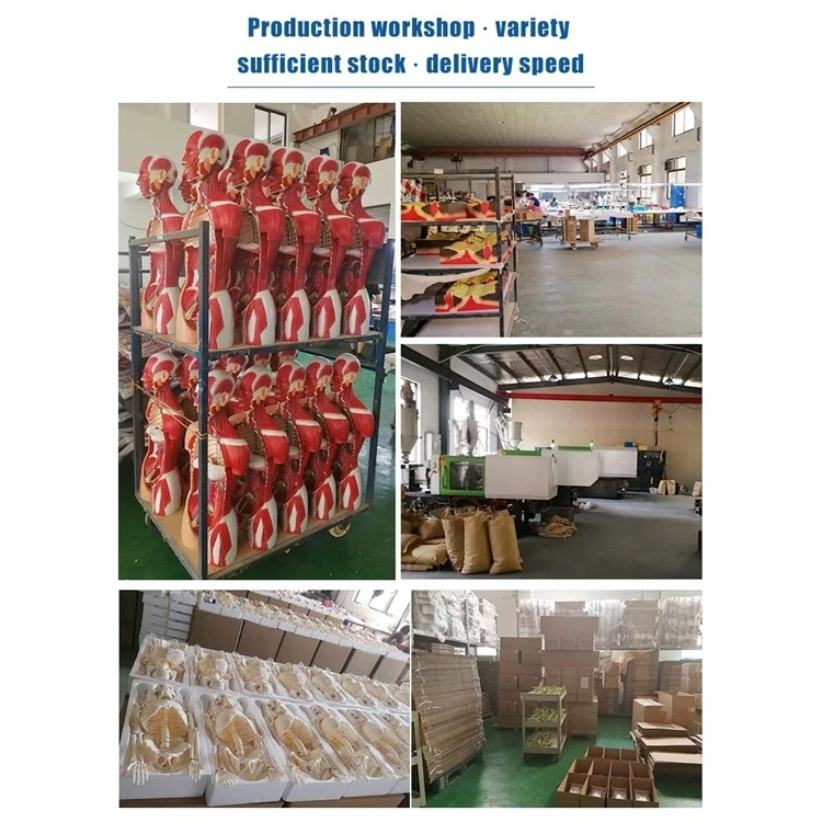 Factory Educational equipment female human anatomy uterine lesion model PVC anatomical model