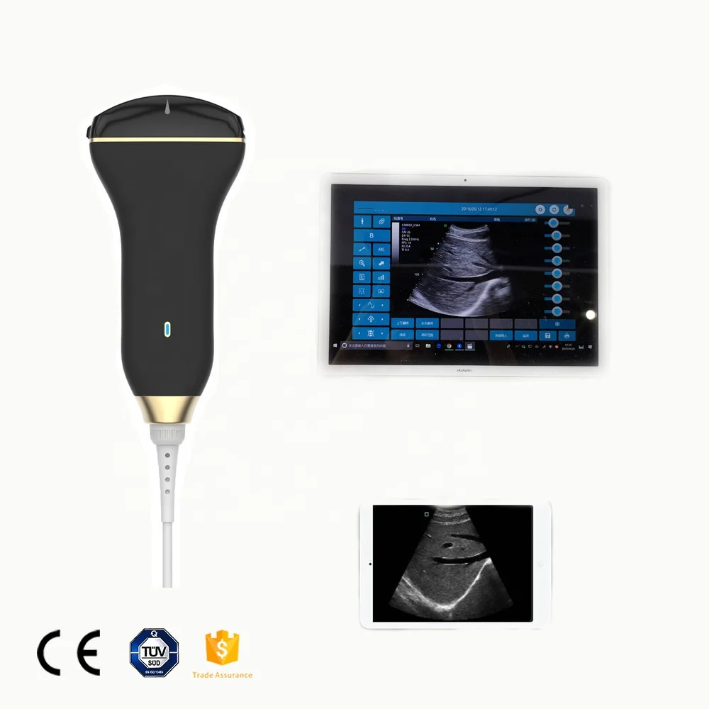 
GYGN-medical portable micro convex ultrasound machine/scanner/equipment/probe for laptop android samsung animal 