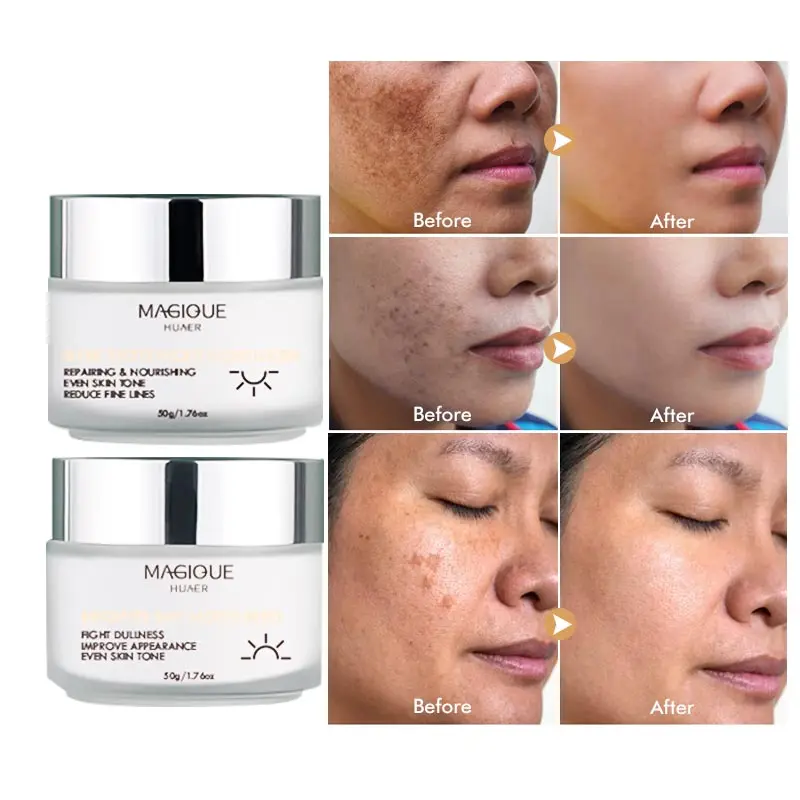 Частная этикетка уход за кожей лица избавление от веснушек удаляет прыщи акне темные пигментные пятна быстрый дневной и ночной режимы отбеливающий крем для мужчин женщин