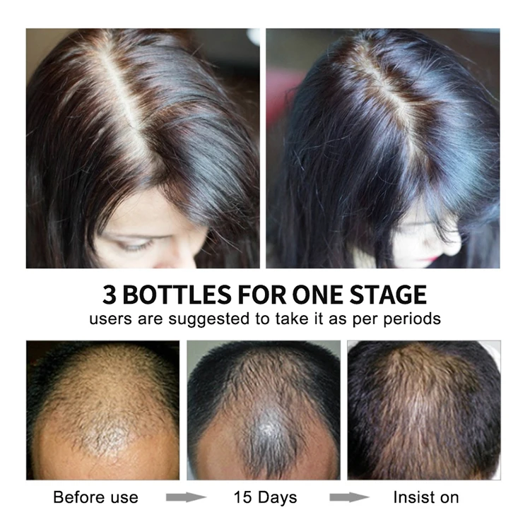 Best bulk extra strength scented all natural herbal hair growth oil alopecia castor oil for hair growth