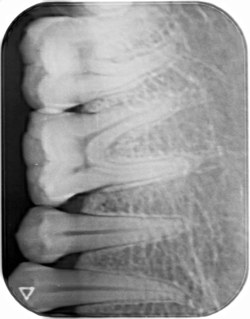 Wholesale Price Cheap Dental PSP Phosphor Plate Scanner For Imaging 2# Phosphor Plate Film Included