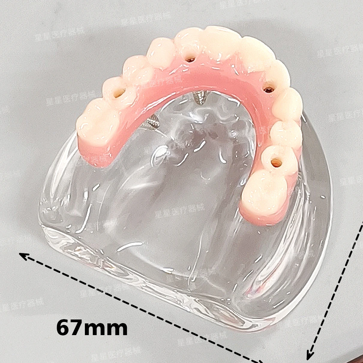 All on 4 speedy model  ALL-ON -4 implant model