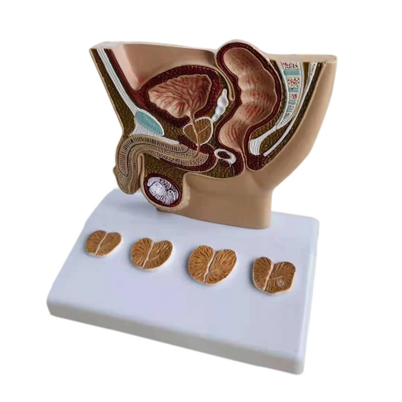 PVC human male pelvis Anatomical with prostate pathology  section medical science