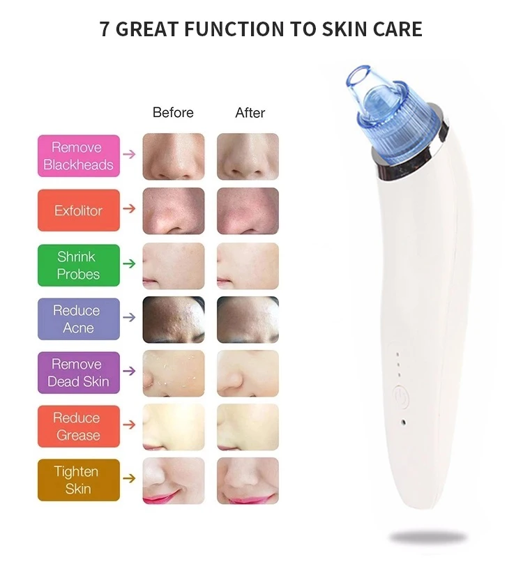Blackhead Remover Pore Vacuum - Electric Face Vacuum Pore Cleaner Acne White Heads Removal with 4 Suction Head