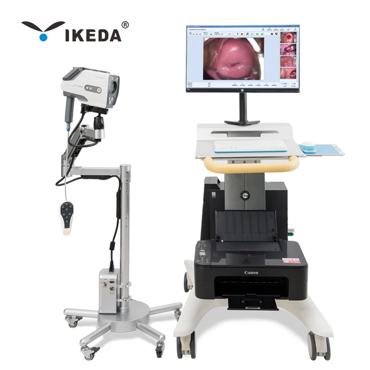 High resolution colposcope video camera colposcopy exam system digital colposcope AKX  YKD-3001
