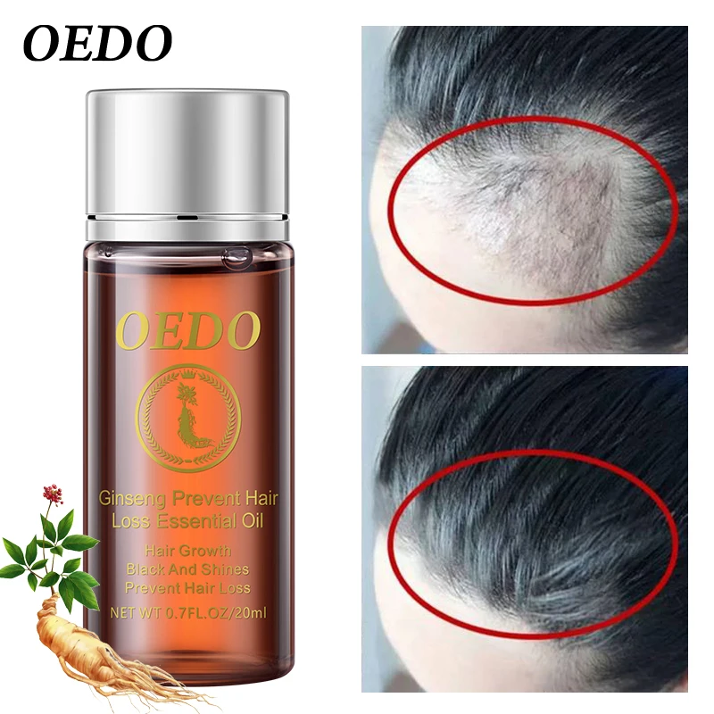  Эфирное масло женьшеня OEDO для ухода за