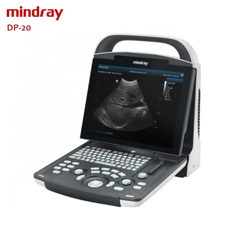 Mindray DP-20 портативный ультразвуковой цена УЗИ аппарат медицинское ультразвуковое оборудование для продажи