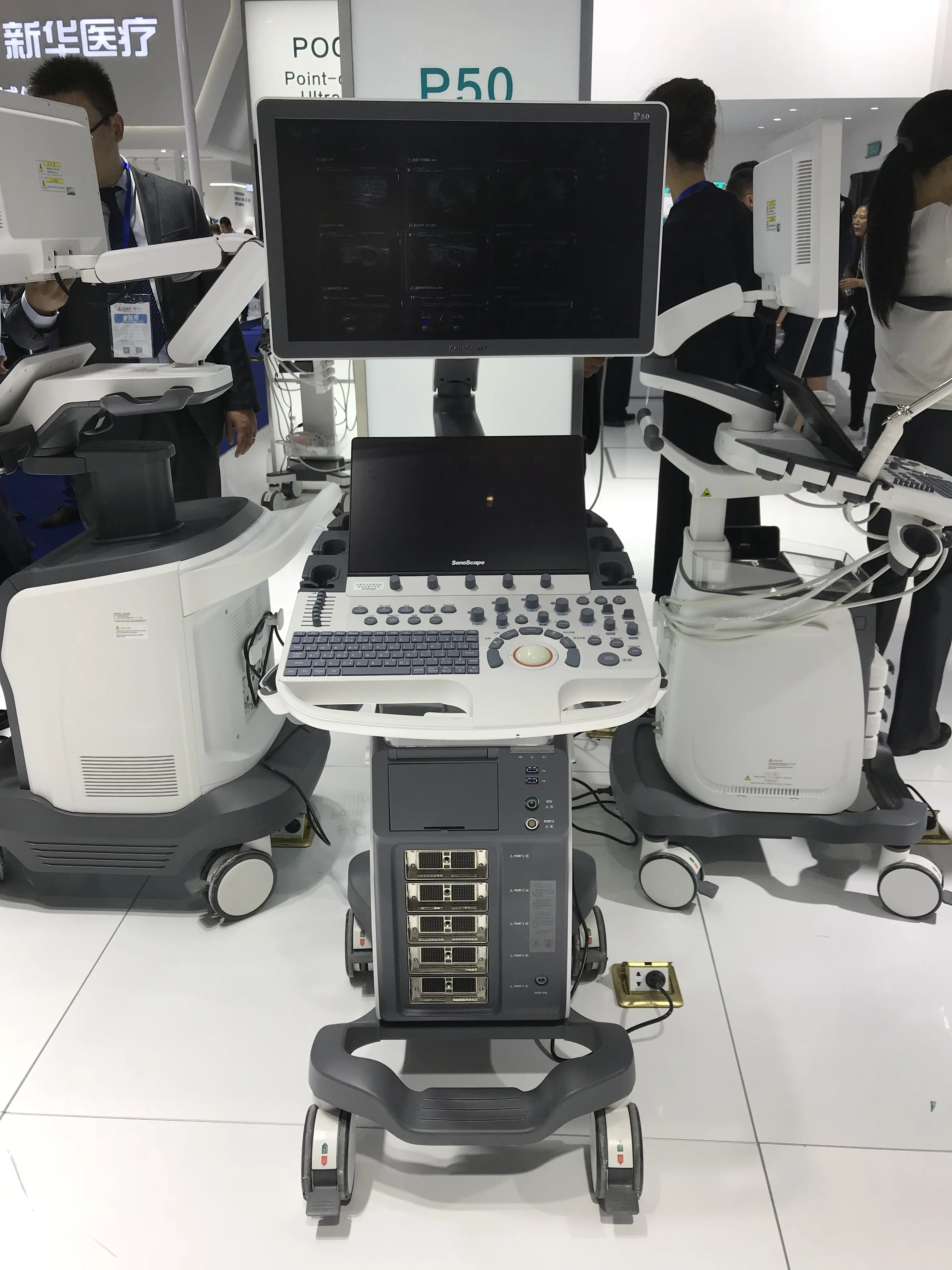 sonoscape p50 elite sonography ultrasound echo machine hospital medical ultrasound instruments