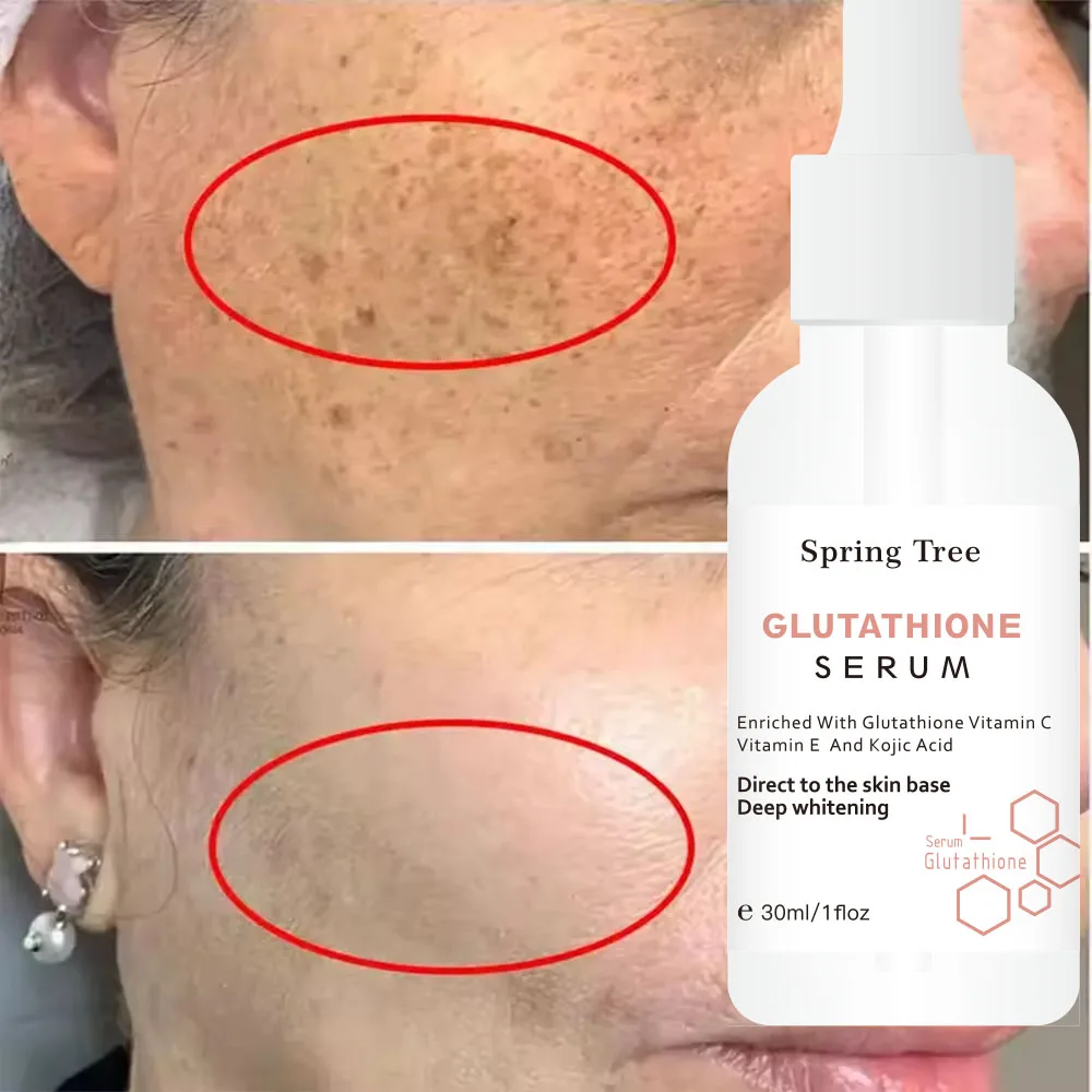 Korea glutathione Kojic Acid Skincare Serum Skin Whitening Facial Serum for Dark Spots Remover