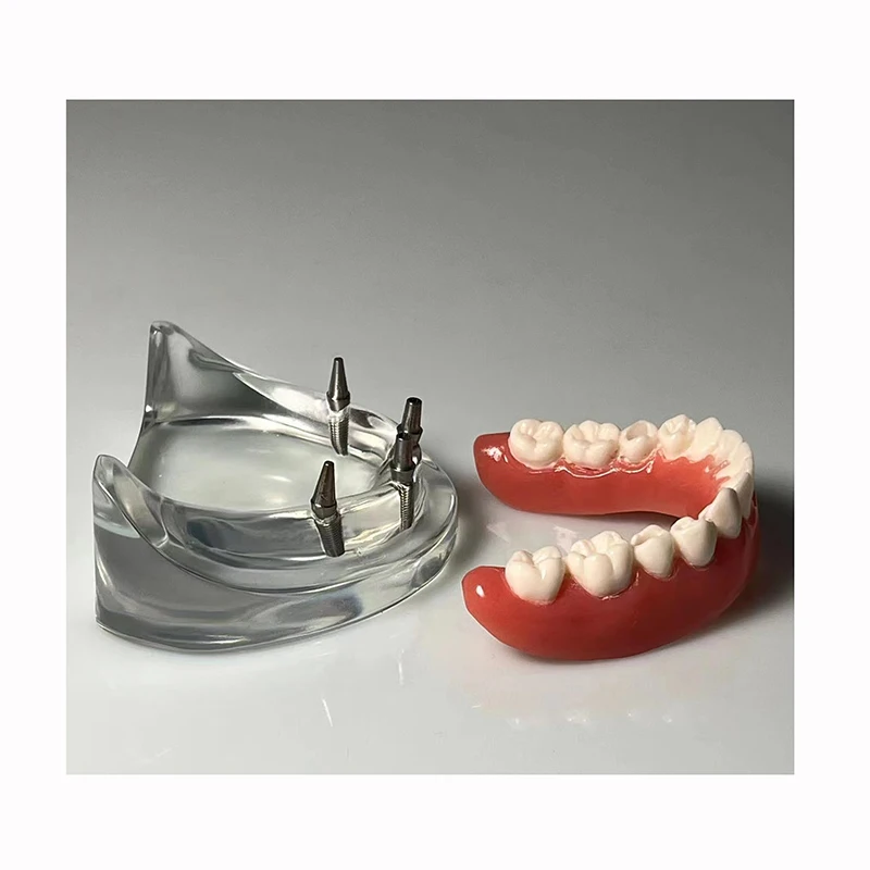 Стоматологический лабораторный протез орально-Анатомический Зуб модель