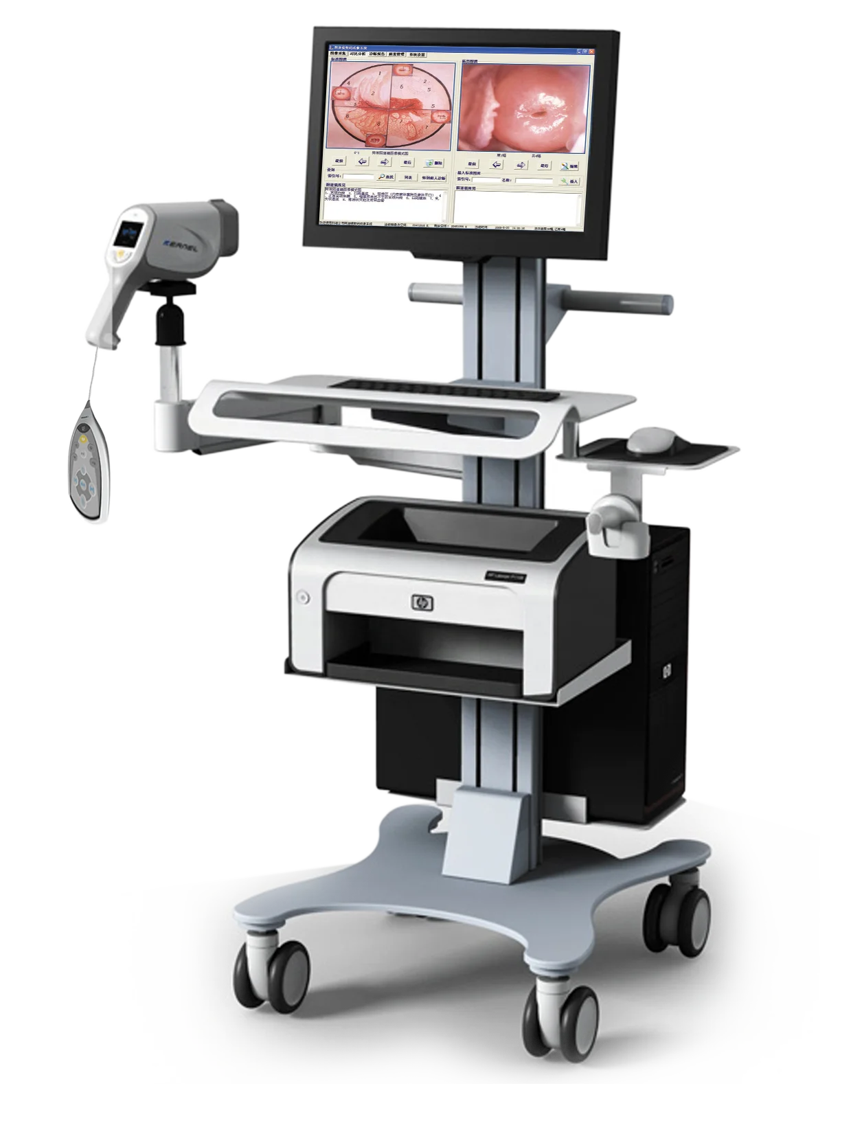 Цифровая система видеосъемки Colposcope Женская вагинальная испытательная камера Colposcopy машина